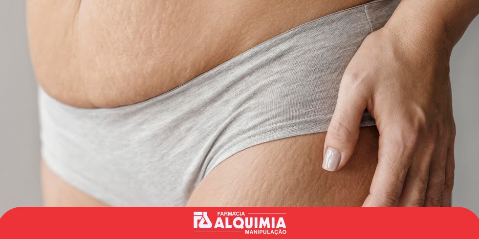 Dimpless: Combate Eficaz Contra as Celulites