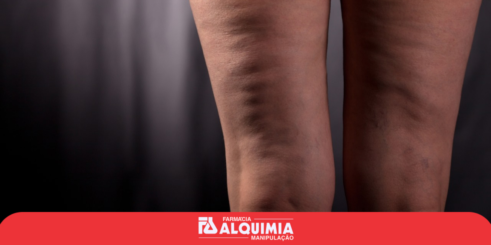ResviTech: Poderoso no Tratamento de Lipedema, Celulite e Doenças Inflamatórias